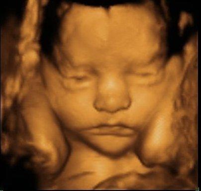 Tiny Toes Prenatal Imaging