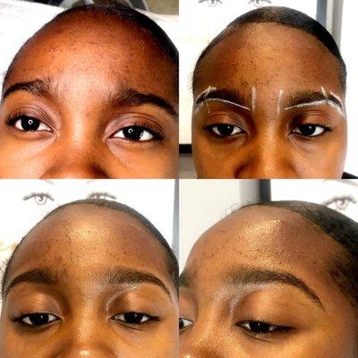 Microdermabrasion + Eye brow Wax & Sculpting