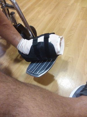 Fixing the ankle