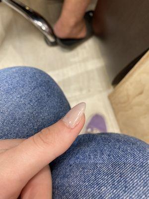 the picture of the hair in my nail