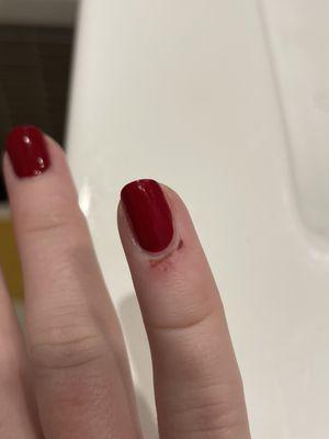 Cuts/Bruising from getting manicure