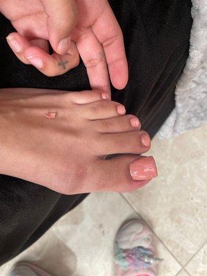 Bad pedi