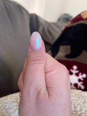 Opposite thumb - wide, uneven, not "almond" at all