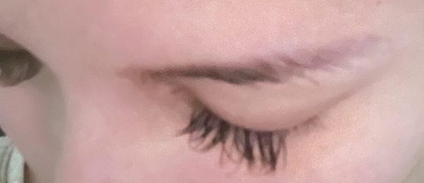 Right side with half of the lashes missing