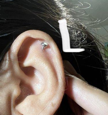 Left ear with flat earring that has now migrated