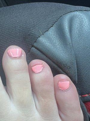 Pedicure done at salon. Cut on second from right toe