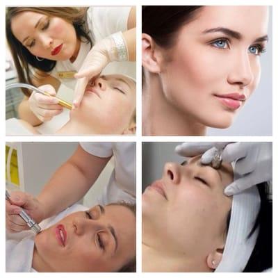 Book a Diamond Tip Microdermabrasion