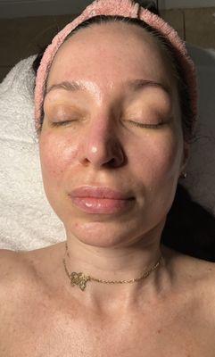 Let it glow.....Anti-aging facial with a glow.