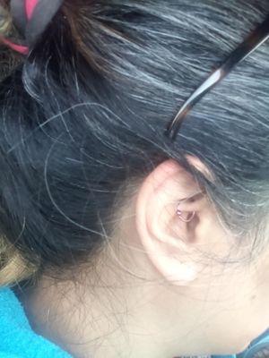 Yes I got the daith piercing