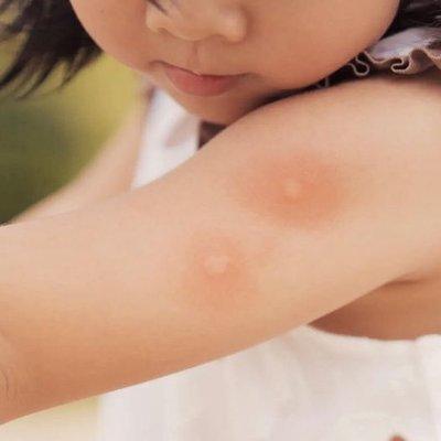 ChildrensDermatology_PediatricDermatologyOC__DrHeidiGoodarzi