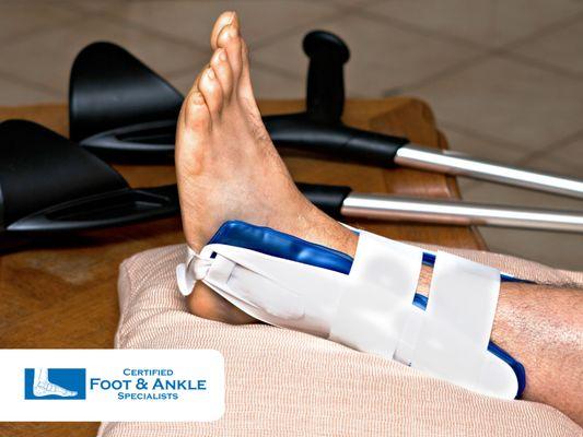 ankle fracture treatment in coconut creek