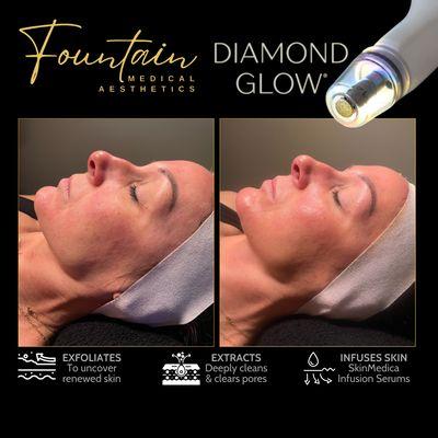 Indulge in our DiamondGlow Facial, a rejuvenating treatment that gently exfoliates, extracts, and infuses the skin with nourishing serums.