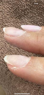 Look how smooth the nail behind is and how thick and chunky and not smooth the two underneath are.