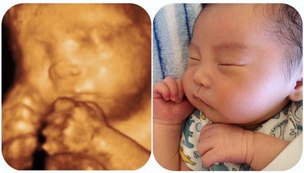 UPDATE* my baby boy is 6 days old now. I would say the 3D/4D pictures are SPOT ON! Lol so cute!