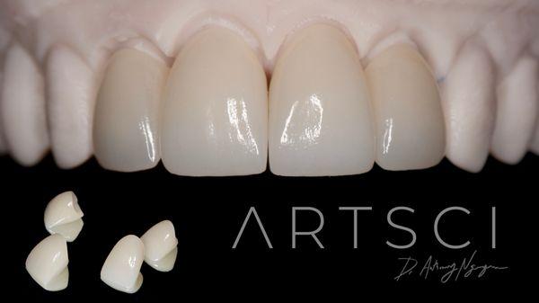 Bespoke dental arts