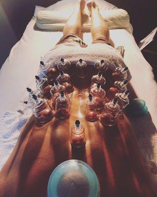 Cupping Therapy