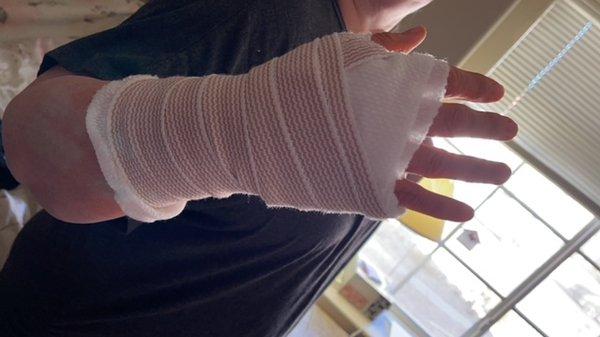 surgery hand