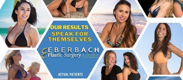 We have more before and after photos than any other Plastic Surgery website in the area. We want our results to speak for themselves