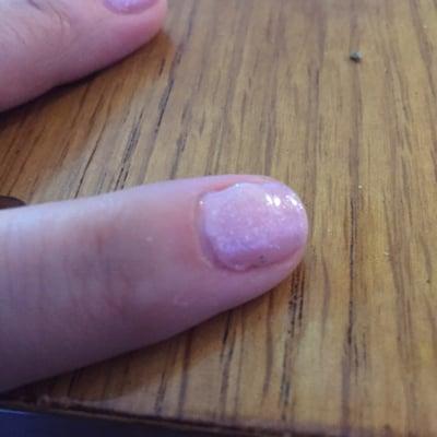 Uneven and blobby polish and sealer application. This happened to 7 of my 10 nails. Not good quality.