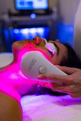 Customized LightStim treatments at The Skin Craft