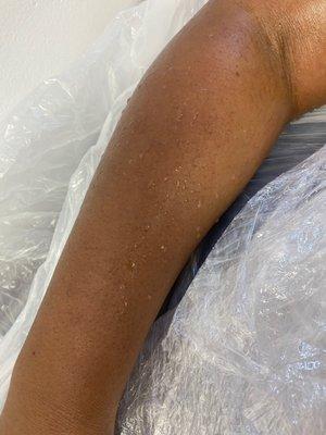 Arm sweat after body wrap