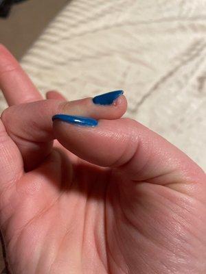 Manicure with torn nail edge