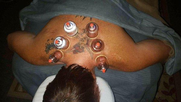 Cupping Massage by Latoya