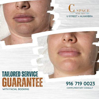 Ask about the Tailored Service Guarantee with our facial treatments!