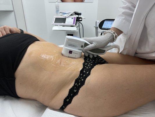 Utims Smas Lifting to remove extra fat and tight the skin