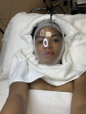 Oxygen treatment after acne facial