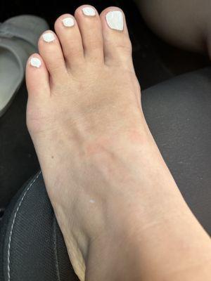 Horrible pedicure.