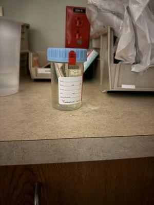 Urine sample...No name, no date, left on the counter to spoil...Hmm?  Yeah, it was mine.  Get it?