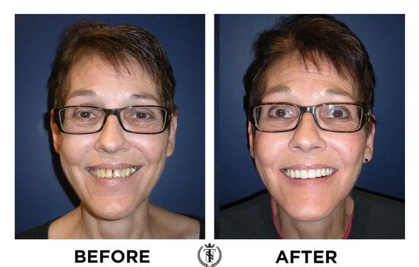 What a difference your dental Health makes!   Make 2022 your BEST Dental Health year ever!!!!