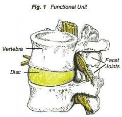 low back pain can be corrected