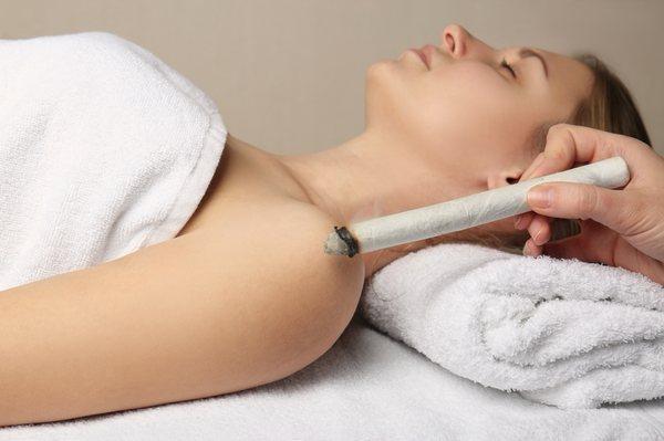 A pratictioner performs moxibustion on a patient.