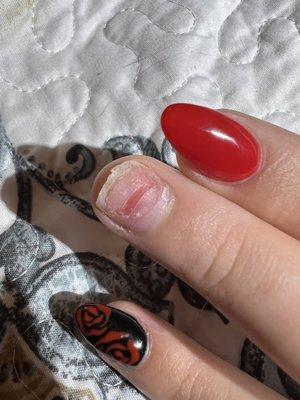 Exposed nail ripped off by tech