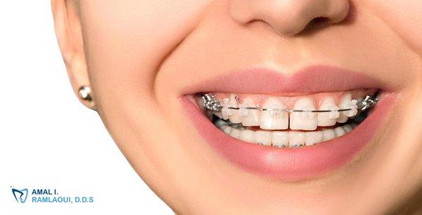 Choosing Ramlouidds for your Invisalign needs means selecting a team dedicated to your satisfaction and comfort.