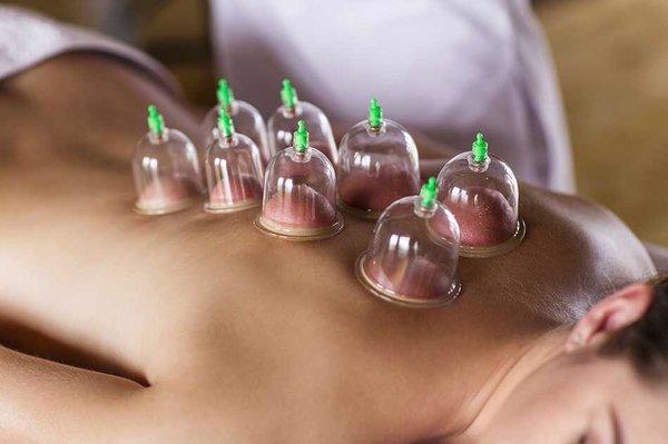 Massage with FREE Cupping Therapy