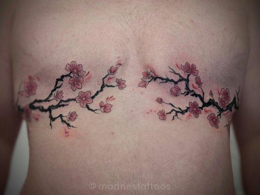 Tattoo with color of cherry blossom branches, covering scars from mastectomy.