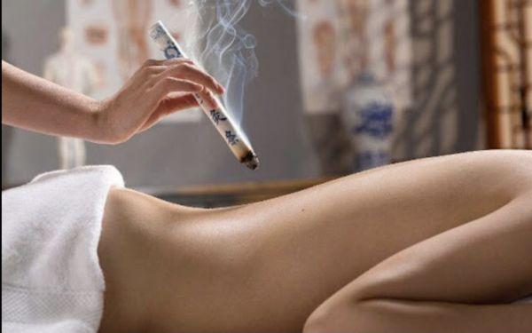 Moxibustion treatment