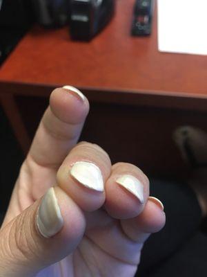 Chipping nails 3 days after