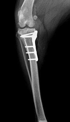 Front to back view of a standard TPLO procedure, immediately after surgery.