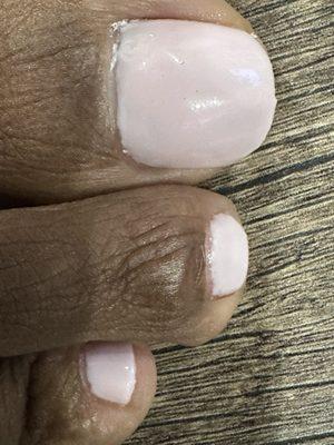 Look at second toe near cuticle line... choppy!