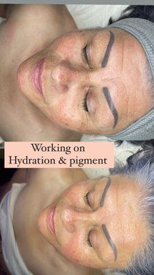 Pre & post facial treatment