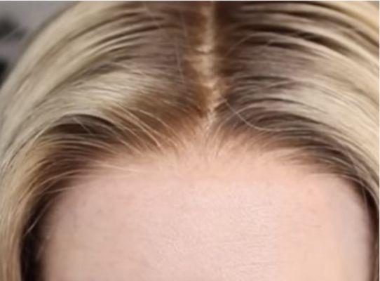 Topper with natural hairline