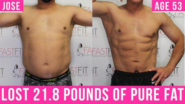 Fast Fit Body Sculpting Fat Weight Loss Review Before and After Skin Tightening