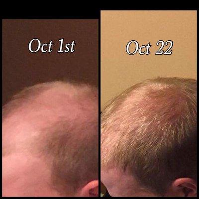 Hair restoration products that really work. Natural based safe... Monat.