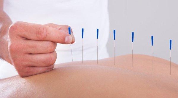 W Day Health is now having new senior Doctor of Acupuncture services, to perform faster masterful pain relieve for wellness of patient need.