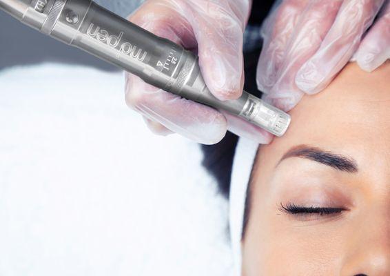 Md pen microneedling, the most powerful microneedling device.