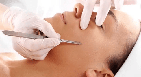 Dermaplaning Treatment